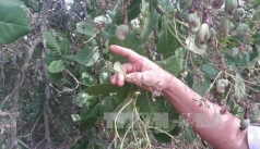 nhung dich benh hai can chu y trong tuan  tu 3   9 4